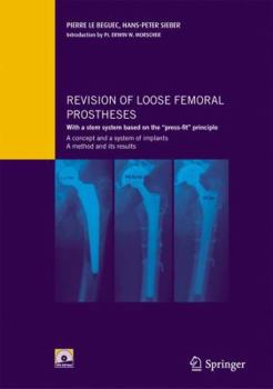 Hardcover Revision of Loose Femoral Prostheses with a Stem System Based on the Press-Fit Principle: A Concept and Its System of Implants, a Method and Its Resul Book