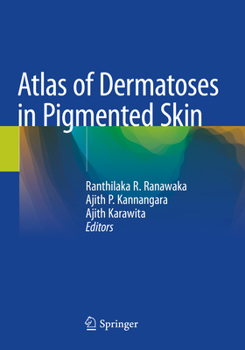 Paperback Atlas of Dermatoses in Pigmented Skin Book