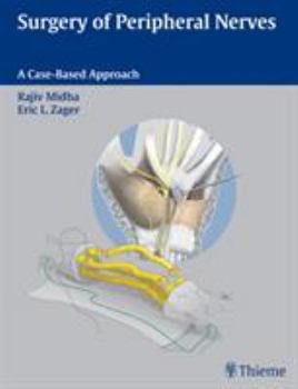 Hardcover Surgery of Peripheral Nerves: A Case-Based Approach Book