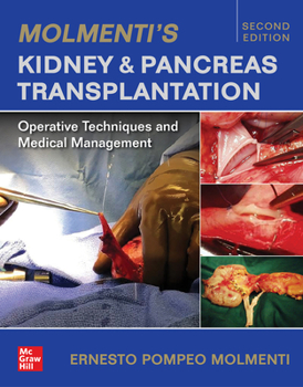 Hardcover Molmenti's Kidney and Pancreas Transplantation: Operative Techniques and Medical Management Book