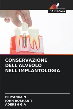 Paperback Conservazione Dell'alveolo Nell'implantologia [Italian] Book
