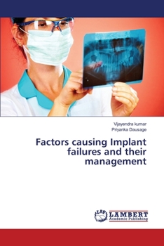 Paperback Factors causing Implant failures and their management Book