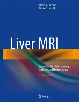 Hardcover Liver MRI: Correlation with Other Imaging Modalities and Histopathology Book