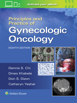 Hardcover Principles and Practice of Gynecologic Oncology Book