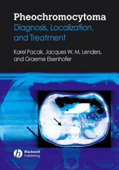 Hardcover Pheochromocytoma: Diagnosis, Localization, and Treatment Book