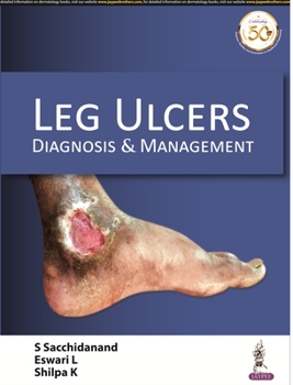 Paperback Leg Ulcers: Diagnosis and Management Book