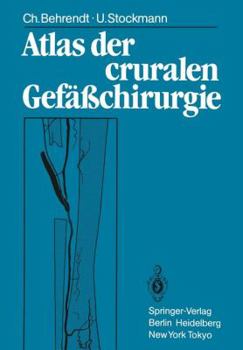 Paperback Atlas Der Cruralen Gefäßchirurgie [German] Book