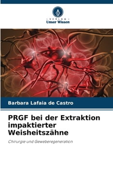 Paperback PRGF bei der Extraktion impaktierter Weisheitszähne [German] Book
