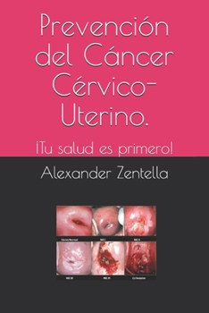 Paperback Prevención del Cáncer Cérvico-Uterino.: ¡Tu salud es primero! [Spanish] Book