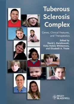 Hardcover Tuberous Sclerosis Complex: Genes, Clinical Features and Therapeutics Book