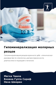 Paperback Гипоминерализация моля&# [Russian] Book