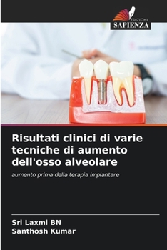 Paperback Risultati clinici di varie tecniche di aumento dell'osso alveolare [Italian] Book