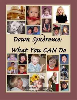 Paperback Down Syndrome: What You CAN Do Book