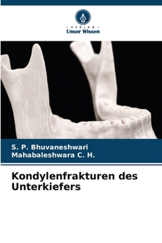 Kondylenfrakturen des Unterkiefers (German Edition)