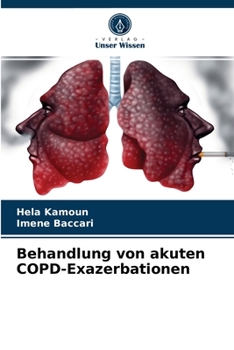 Paperback Behandlung von akuten COPD-Exazerbationen [German] Book