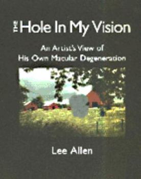 Paperback The Hole in My Vision Book