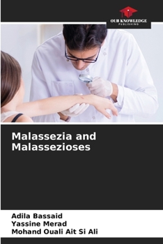 Paperback Malassezia and Malassezioses Book