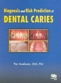 Hardcover Diagnosis and Risk Prediction of Dental Caries, Volume 2 Book