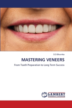 Mastering Veneers