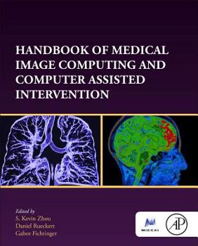 Hardcover Handbook of Medical Image Computing and Computer Assisted Intervention Book