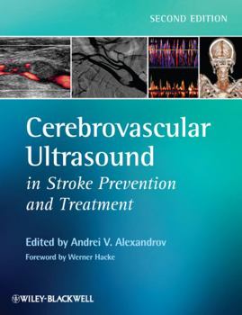 Hardcover Cerebrovascular Ultrasound in Stroke Prevention and Treatment Book
