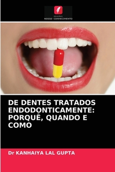 Paperback de Dentes Tratados Endodonticamente: Porquê, Quando E Como [Portuguese] Book