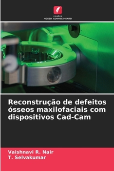 Reconstrução de defeitos ósseos maxilofaciais com dispositivos Cad-Cam (Portuguese Edition)