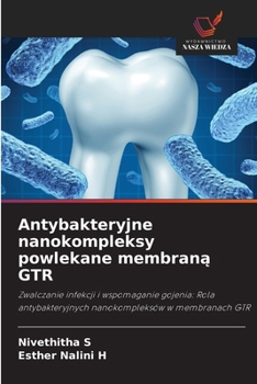 Antybakteryjne nanokompleksy powlekane membrana GTR (Polish Edition)