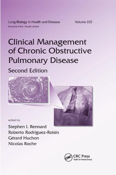 Paperback Clinical Management of Chronic Obstructive Pulmonary Disease Book
