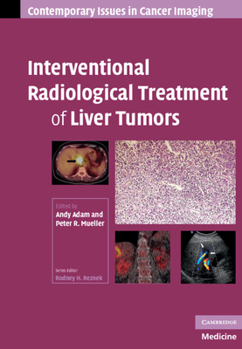 Hardcover Interventional Radiological Treatment of Liver Tumors Book