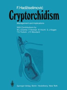 Paperback Cryptorchidism: Management and Implications Book