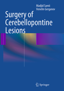 Paperback Surgery of Cerebellopontine Lesions Book