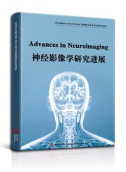 Paperback Advances in Neuroimaging [Middle_English] Book