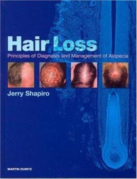 Hardcover Hair Loss: Principles of Diagnosis and Management of Alopecia Book