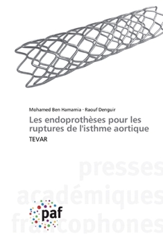 Paperback Les endoprothèses pour les ruptures de l'isthme aortique [French] Book