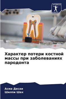 Paperback Характер потери костной [Russian] Book