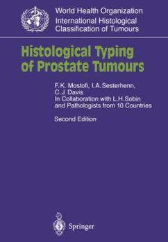 Paperback Histological Typing of Prostate Tumours Book