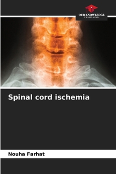 Paperback Spinal cord ischemia Book