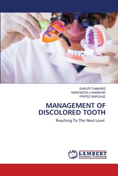 Paperback Management of Discolored Tooth Book