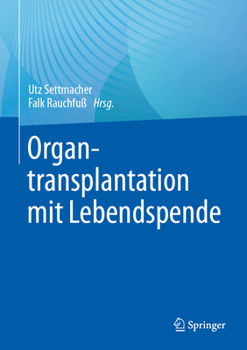 Hardcover Organtransplantation Mit Lebendspende [German] Book