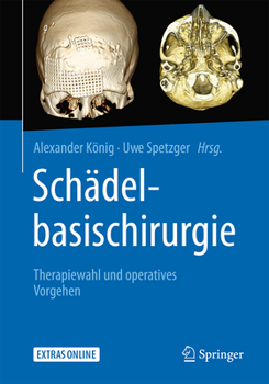 Hardcover Schädelbasischirurgie: Therapiewahl Und Operatives Vorgehen [German] Book
