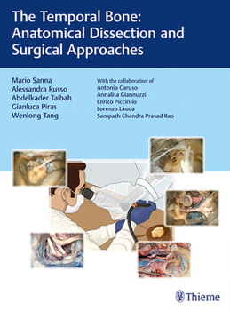 Hardcover The Temporal Bone: Anatomical Dissection and Surgical Approaches Book