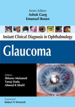 Paperback Glaucoma Book