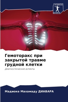 Paperback Гемоторакс при закрытой [Russian] Book