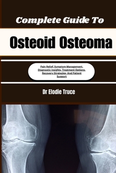 Complete Guide To Osteoid Osteoma: Pain Relief, Symptom Management, Diagnostic Insights, Treatment Options, Recovery Strategies, And Patient Support