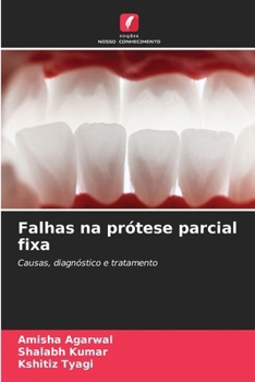 Falhas na prótese parcial fixa (Portuguese Edition)