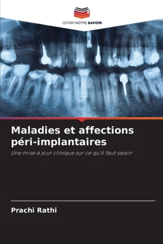 Paperback Maladies et affections péri-implantaires [French] Book