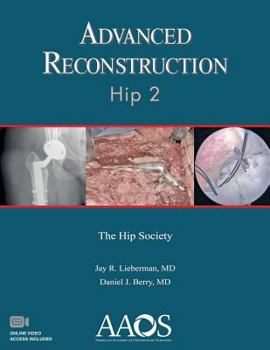 Paperback Advanced Reconstruction Hip Book