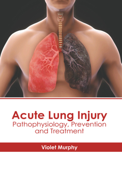 Hardcover Acute Lung Injury: Pathophysiology, Prevention and Treatment Book