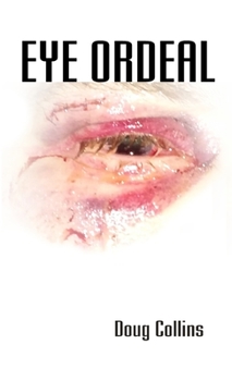 Paperback Eye Ordeal Book